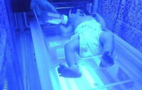 新生儿照蓝光有什么副作用,蓝光对新生儿有害吗？如何预防？