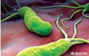 幽门螺旋杆菌是什么原因引起的,幽门螺杆菌感染为什么那么可怕？