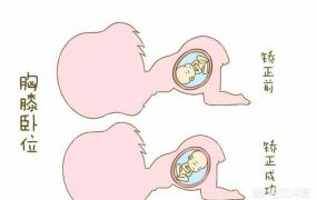 枕骨在哪个位置图,怀孕6个月，宝宝在什么位置？