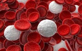白血病的血常规,血常规正常能排除白血病吗？