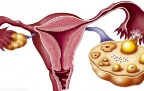 输卵管妊娠的自我检查、症状及治疗方法