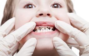 美国牙医让孩子少吃糖果的妙招