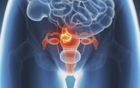 排尿困难或不畅竟是卵巢癌的信号 卵巢癌的饮食禁忌