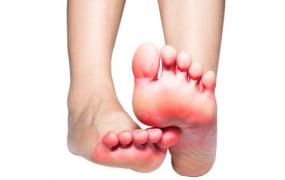 有脚气经常用盐水泡脚能杀菌吗 脚气病用药治疗法则