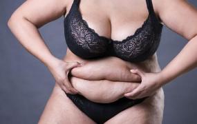 肥胖引起的并发症 肥胖是导致多种癌症的诱因之一