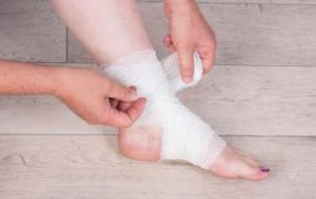 扭伤脚是先冷敷还是热敷 不同关节扭伤处理方法不同
