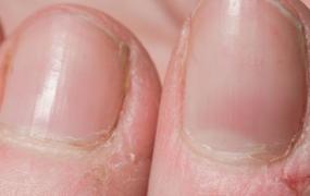 健康状况跟手指月牙有关吗 月牙多少和体质强弱关系