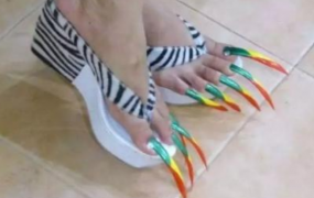 世界上脚趾甲最长的人:长达10年未剪趾甲(最长15.2厘米)