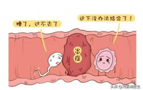 输卵管不通最明显症状,怎样检查输卵管是否通畅？