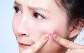 脸颊长痘痘什么原因,女性脸颊长痘是什么原因？