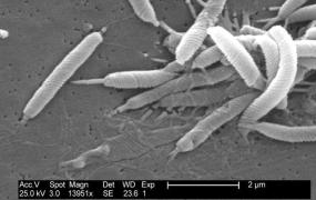 幽门螺旋杆菌是怎么引起的,哪些人容易感染幽门螺旋杆菌？
