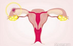 宫外孕的表现,宫外孕危险吗，什么症状？