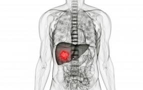 肝癌的早期症状和前兆,肝癌的五大早期症状是什么？