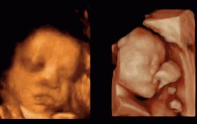 6个月的胎儿,怀孕6个月时，胎儿长什么样子？