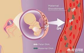 孕妇做无创dna最佳时间,什么时候做无创DNA比较好？
