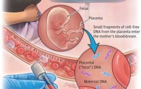 孕妇做无创dna最佳时间,无创DNA产前检测必要吗？