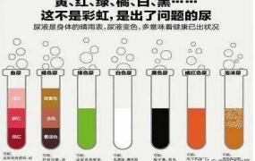 淡绿色尿液图片,不同颜色尿液是否预示不同疾病？