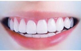 如何使黄牙变白牙,牙齿很黄，而且刷不白该怎么办？