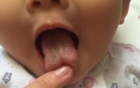 舌苔怎么清洁,宝宝的舌苔怎么清洁比较好？