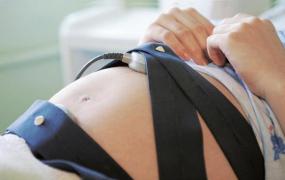 胎心监护怎么看宫缩,孕妈产检，胎心监护到底是什么？
