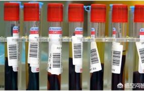 采血管颜色抽血顺序,医院每次抽血为什么抽那么多？
