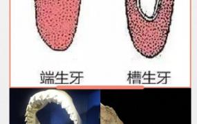 鲨鱼牙,人类和鲨鱼的牙齿是否一样坚硬？