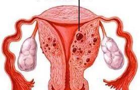 子宫移位能怀孕吗,子宫内膜异位还能怀孕吗？